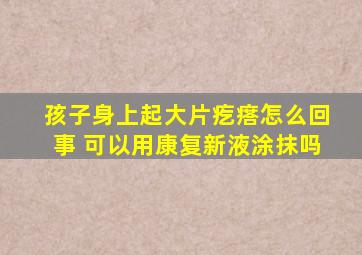 孩子身上起大片疙瘩怎么回事 可以用康复新液涂抹吗